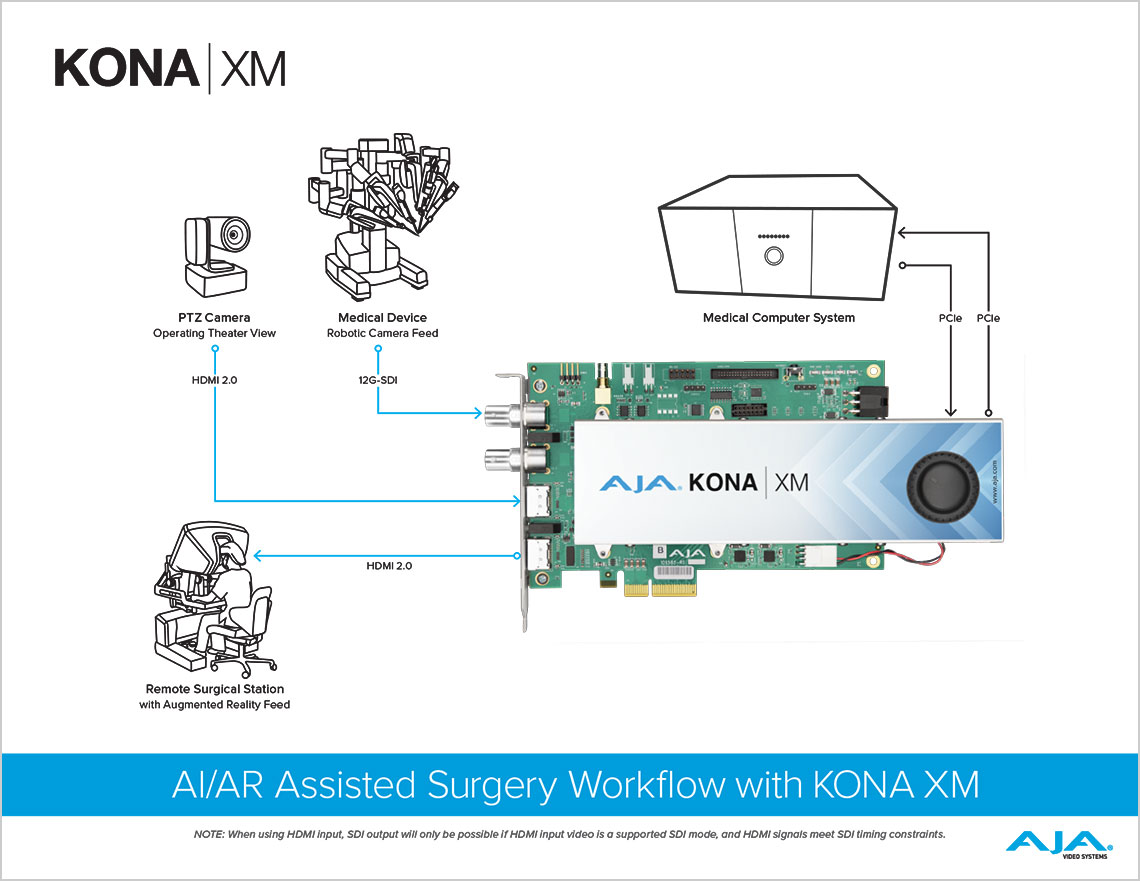  KONA XM 拡張現実手術支援ワークフロー図